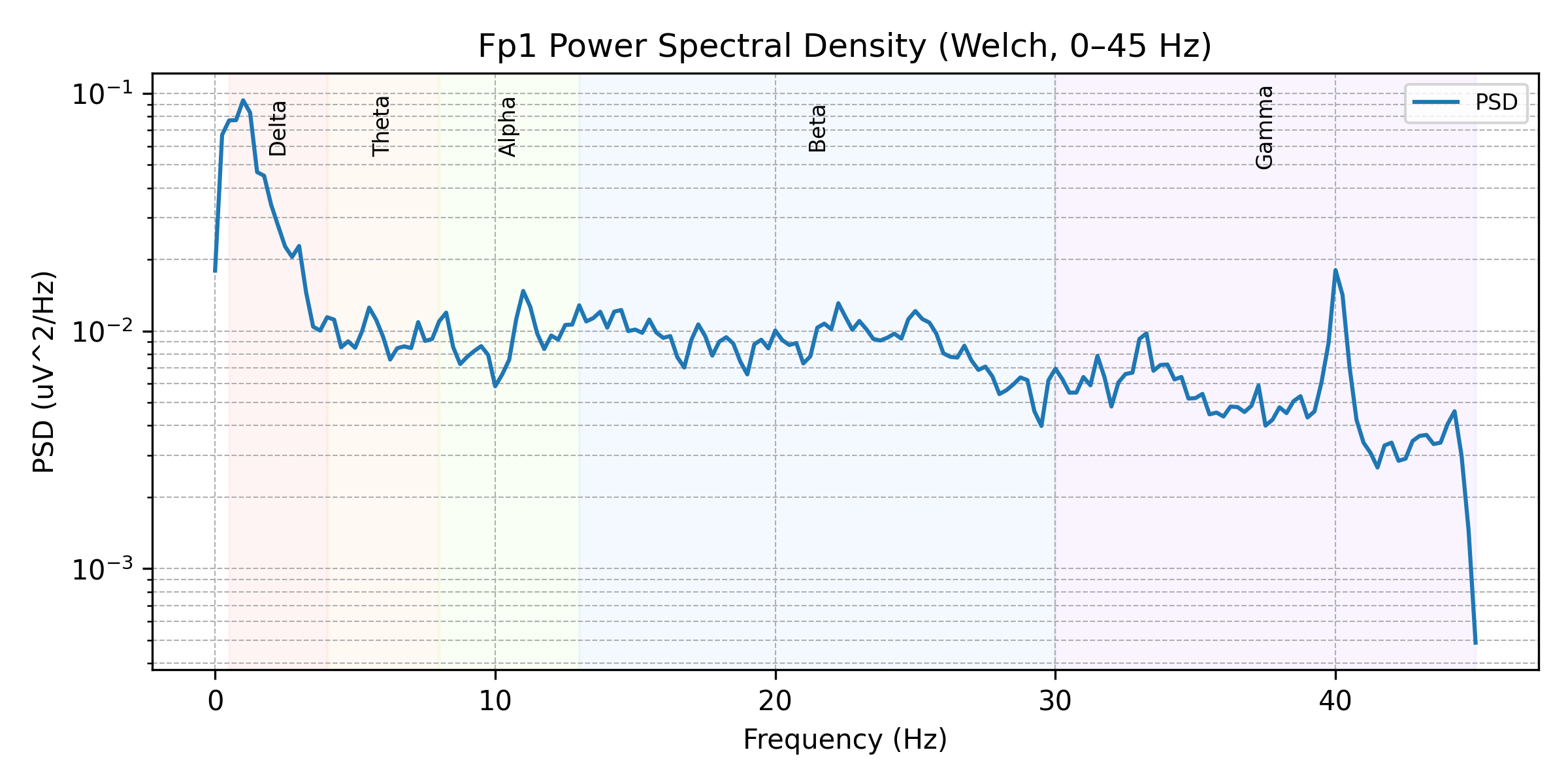 PSD EEG